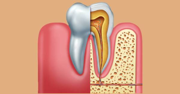 Why Do You Need Emergency Dentistry in Grand Prairie?