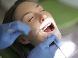 Deep Teeth Cleaning