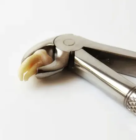 Emergency Tooth Extraction in Grand Prairie