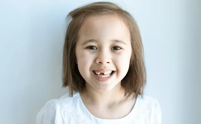 Dental Extraction in Grand Prairie