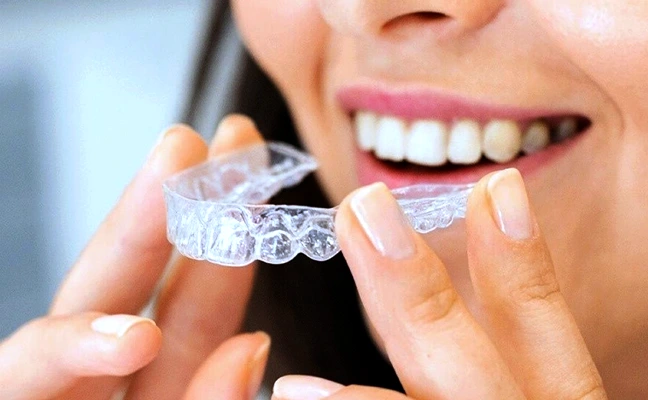 Invisalign Grand Prairie