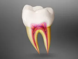 Root Canal Treatment